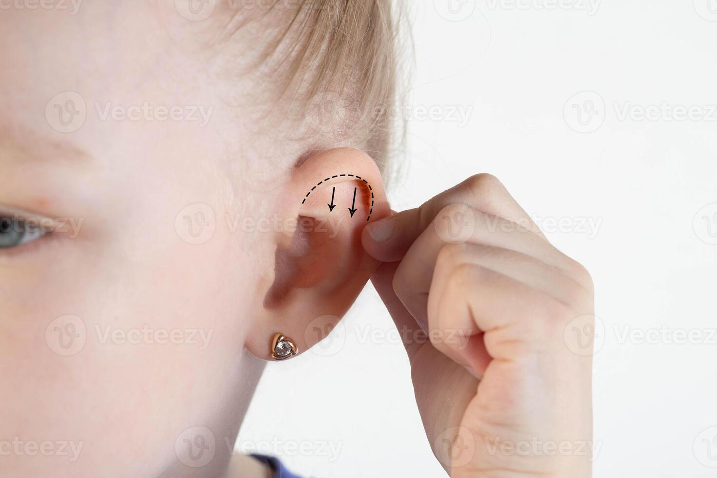 A girl holds her ear with her hand on a white background. The concept of changing ear shapes in children. Pediatric otoplasty. Copy space for text photo