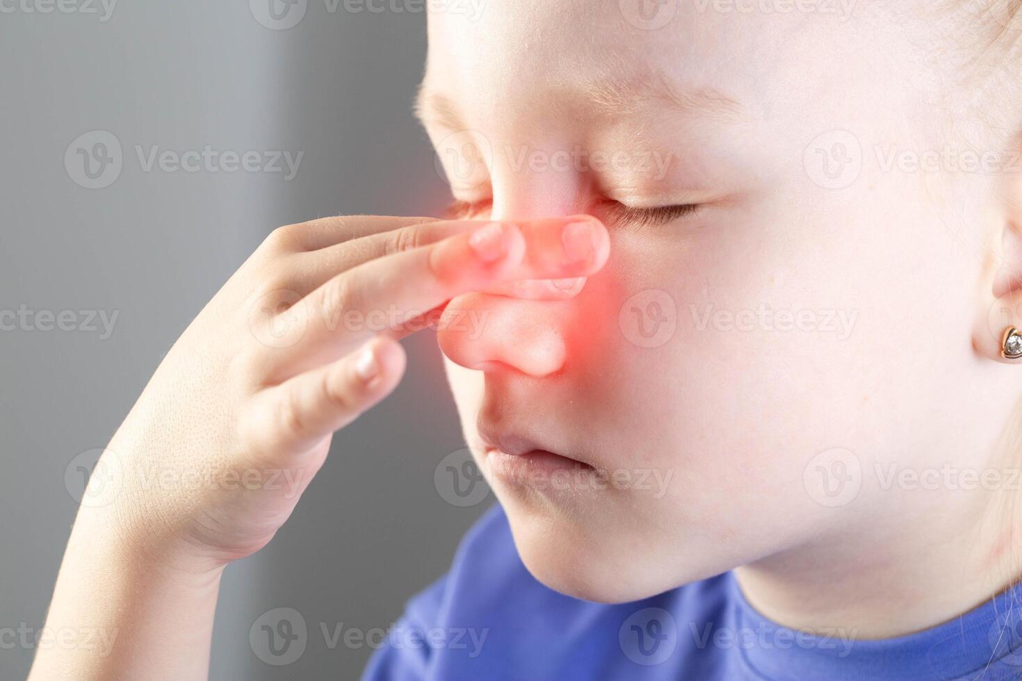 A girl is holding her red nose whose skin is irritated due to a runny nose. Pain in the maxillary sinuses, runny nose. photo