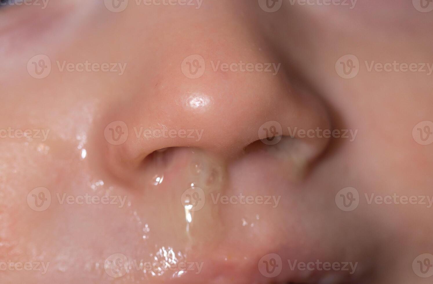 Close-up of a small child's face and nose with snot. The concept of colds, rhinitis and runny nose in children. photo