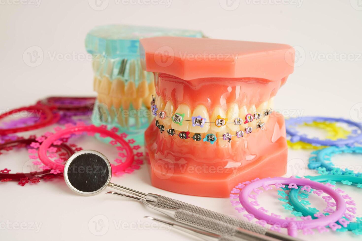Orthodontic ligatures rings and ties, elastic rubber bands on orthodontic braces, model for dentist studying about dentistry. photo