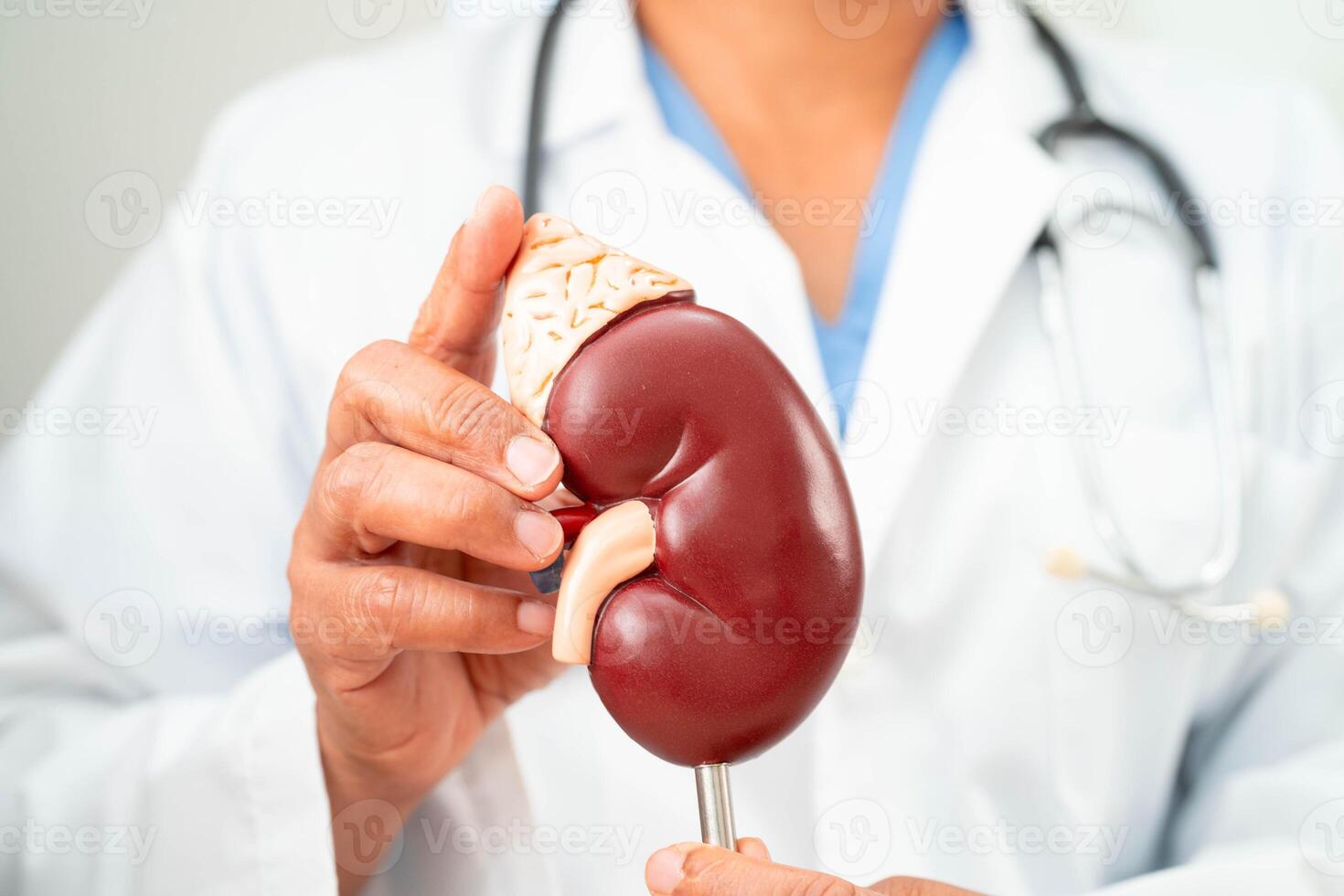Chronic kidney disease, doctor with model for treatment urinary system, urology, Estimated glomerular filtration rate eGFR. photo