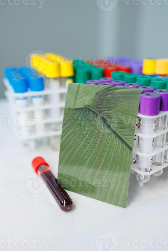 Test tubes with blood. Taking blood from a vein for research photo
