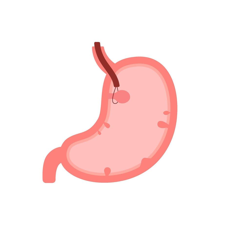 Stomach organ with polyp, gastroscopy and removal polyp. Check health of stomach. Unhealthy gastric, indigestion problems, disease concept. Risk growth cancer cells in stomach. flat illustration vector