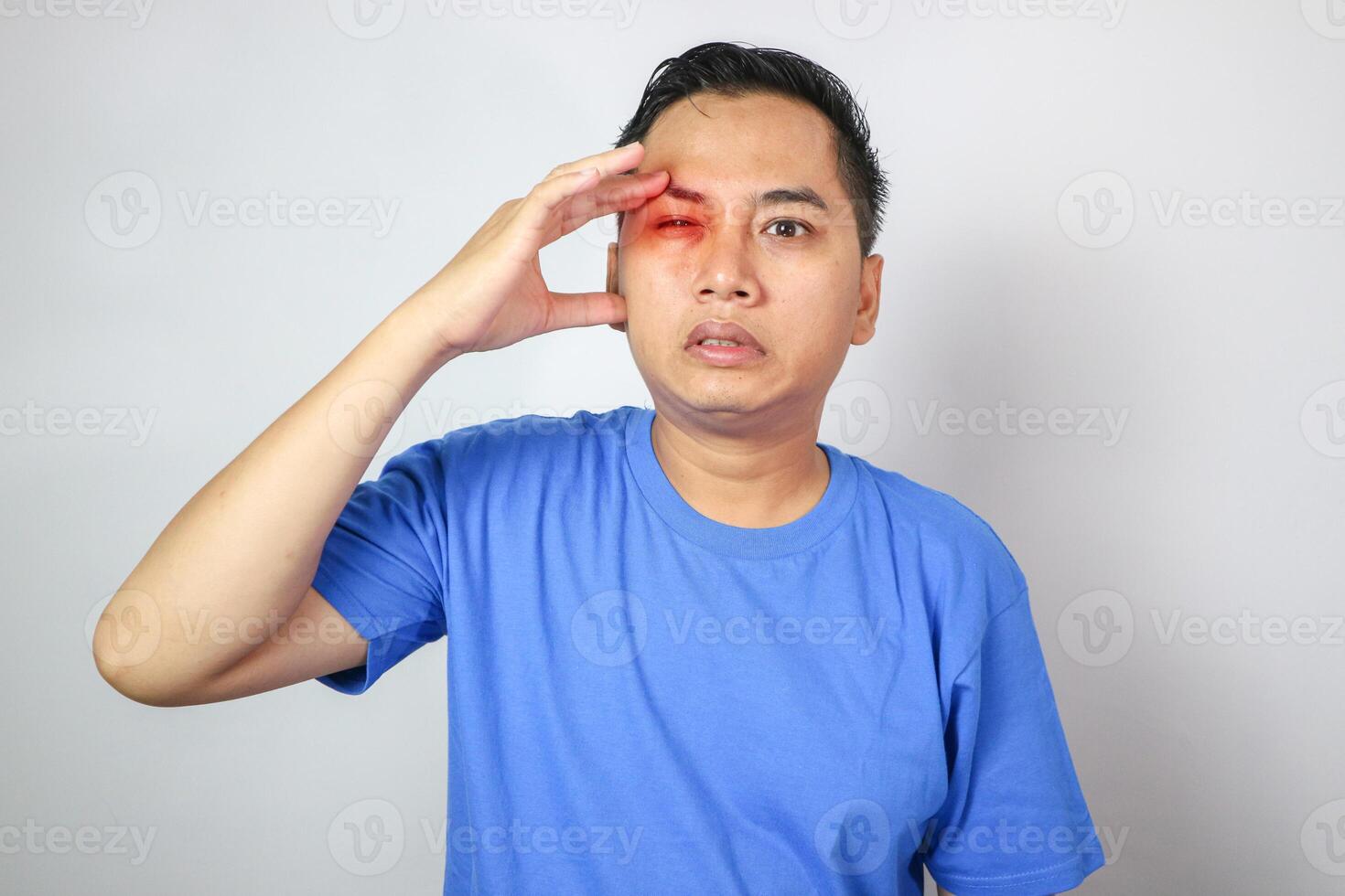 Young man touching his temple and having strong tension headache. Cluster headache. Man suffering from migraine, stress, hangover with red alert accent. Hands on head photo
