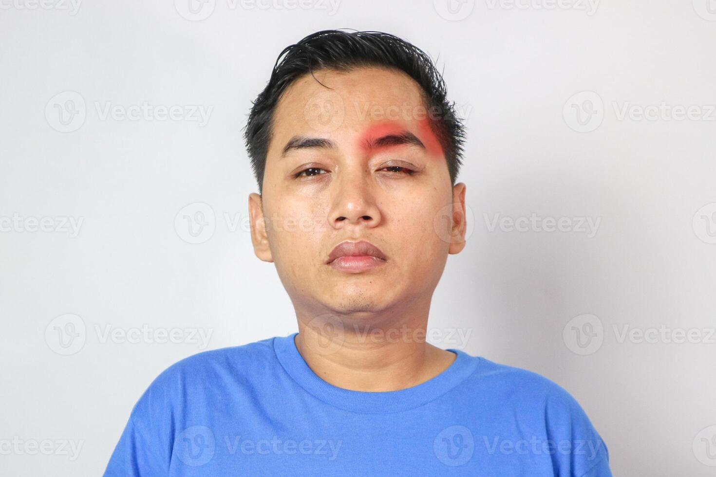 Head pain medicines pills concept. Cephalalgia and migraine. Man with sinus headache, tension or cluster headache on gray studio. Migraine symptoms. Chronic headaches. Headache triggers. photo