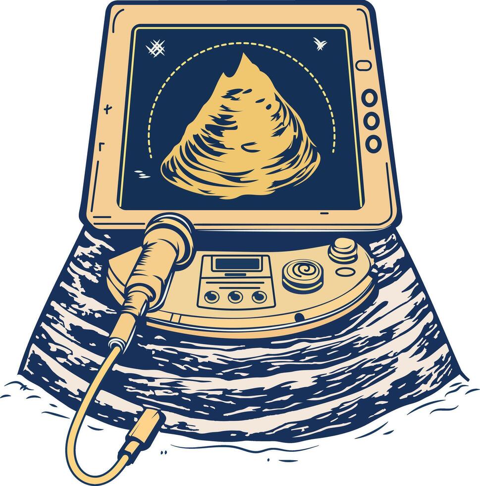 Ultrasound machine illustration in vintage style vector