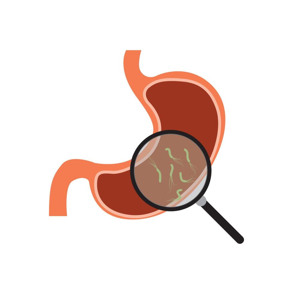 Helicobacter Pylori in the stomach. Stomach diseases. Bacterium with flagella that causes gastritis. Bacteria under magnifying glass. Illustration on white background vector