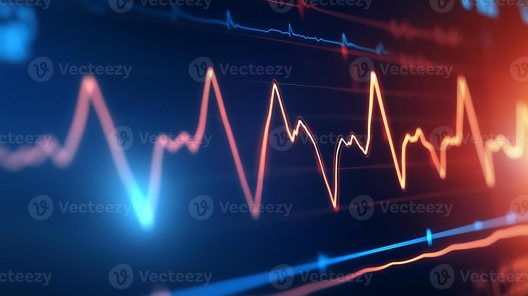 Intricate Medical ECG Display Showing Heartbeat Activity in Detailed Graph Lines photo