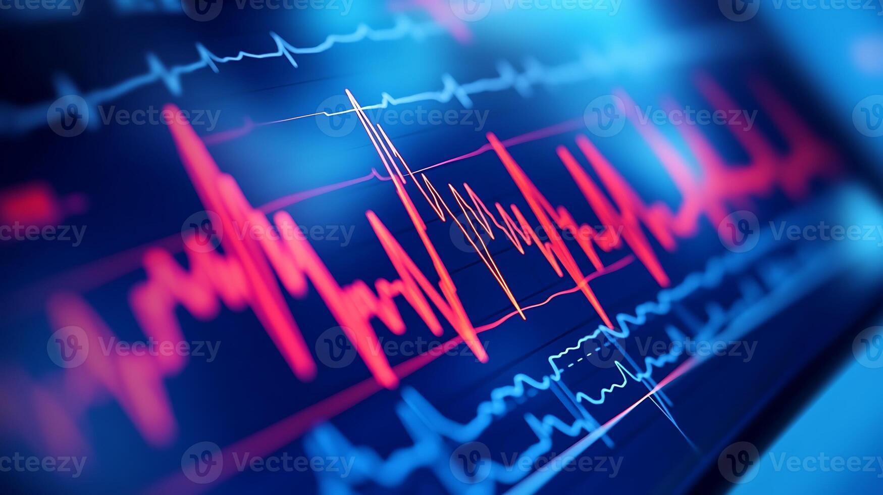 ECG Graph Lines Monitoring Heart Rhythm Captured on Advanced Close-Up Display photo