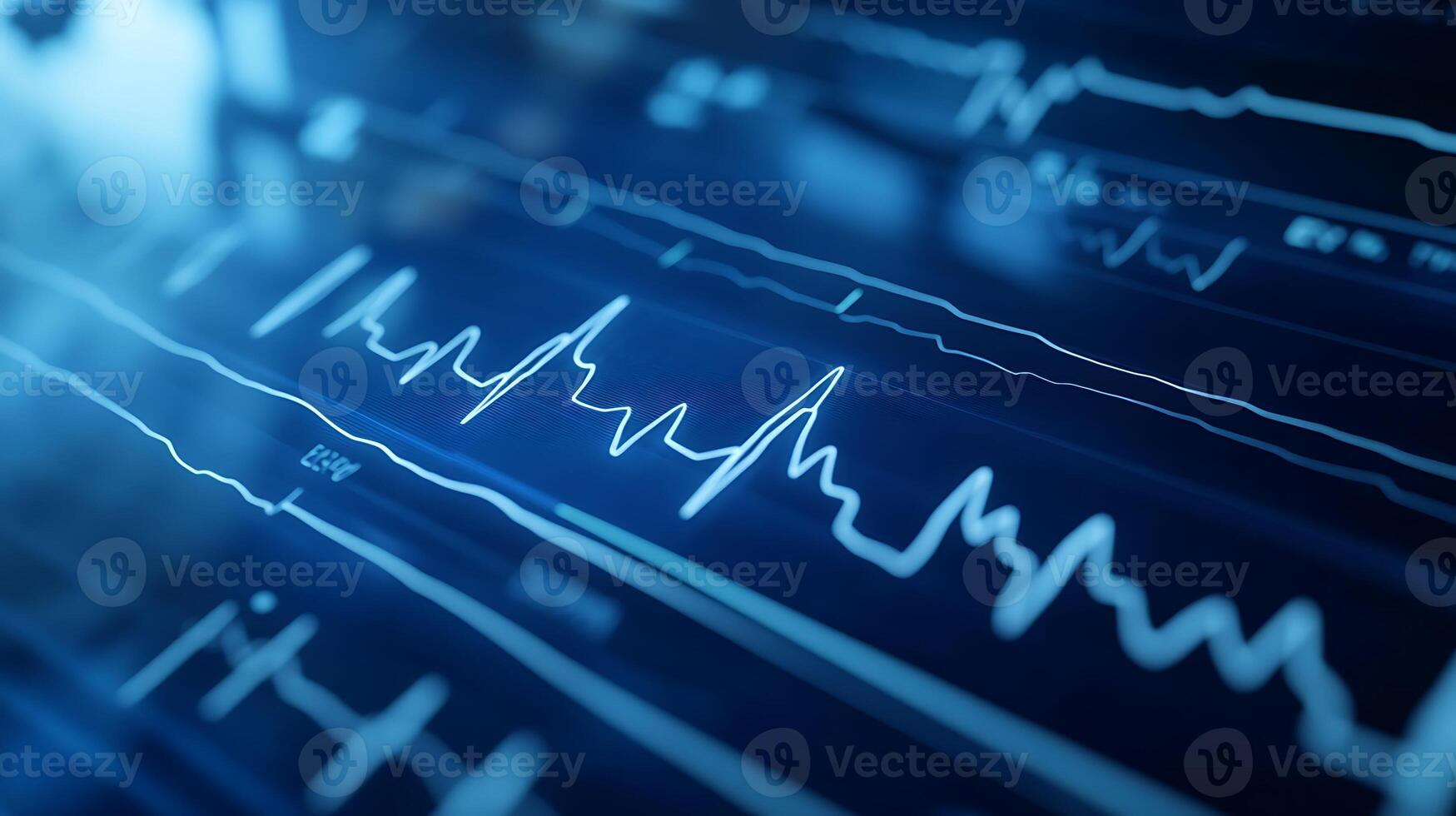 Heart's Electrical Activity Monitored via Real-Time ECG Graph Display Close-Up photo