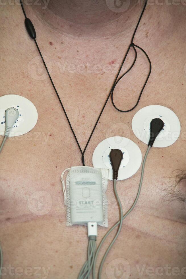 Electrodes attached to a chest during a medical procedure for monitoring photo