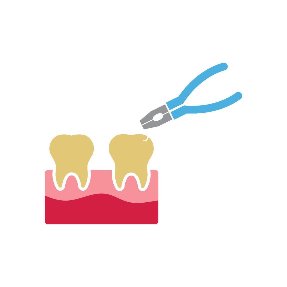Dental pliers removing a cracked tooth from gum tissue vector
