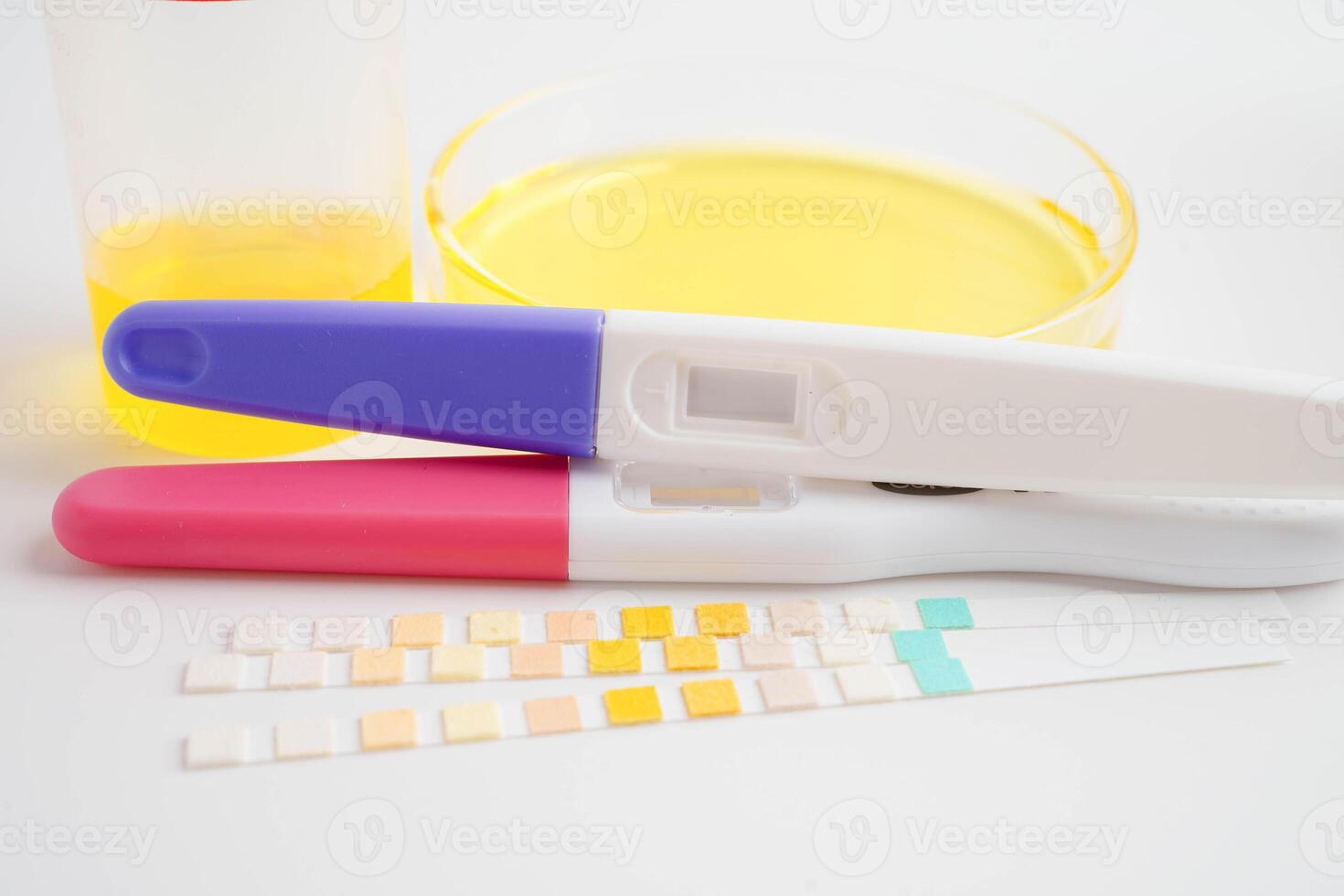 Urinalysis, urine cup with reagent strip pH paper test and comparison chart in laboratory. photo