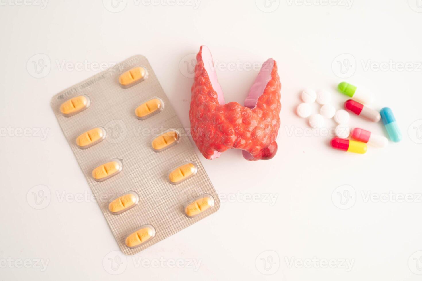 Thyroid model with pill drug treatment, Hyperthyroidism, Overactive or Lymphoma. photo