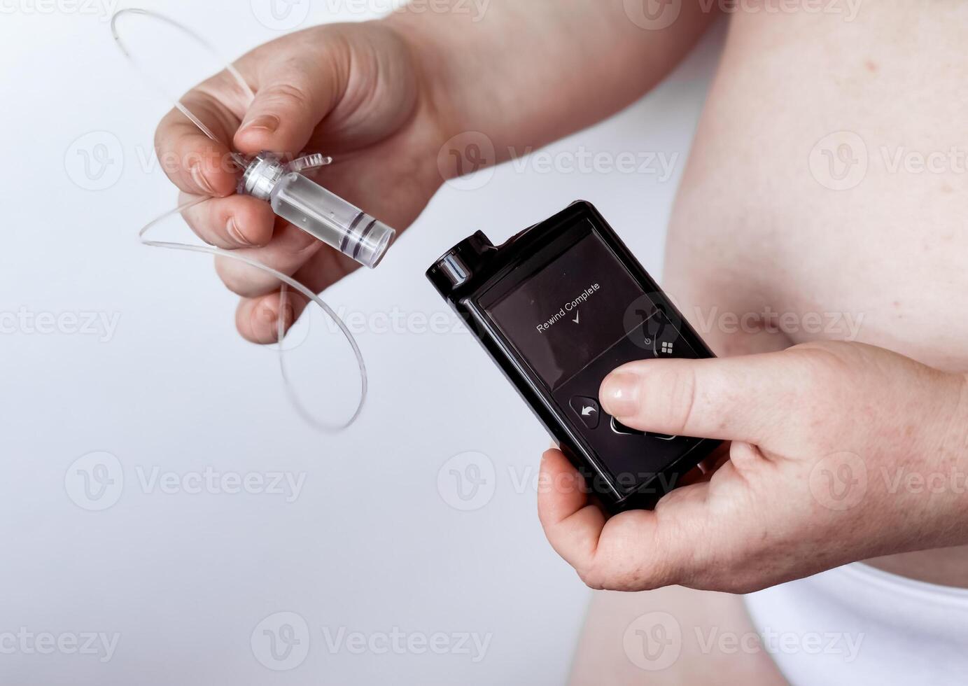Person holding insulin pump and infusion set for diabetes management photo