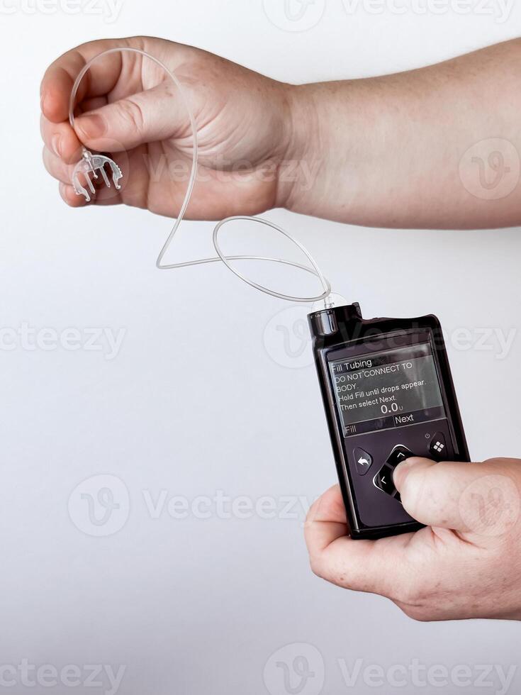 Modern insulin pump device and sensor technology for diabetes management photo