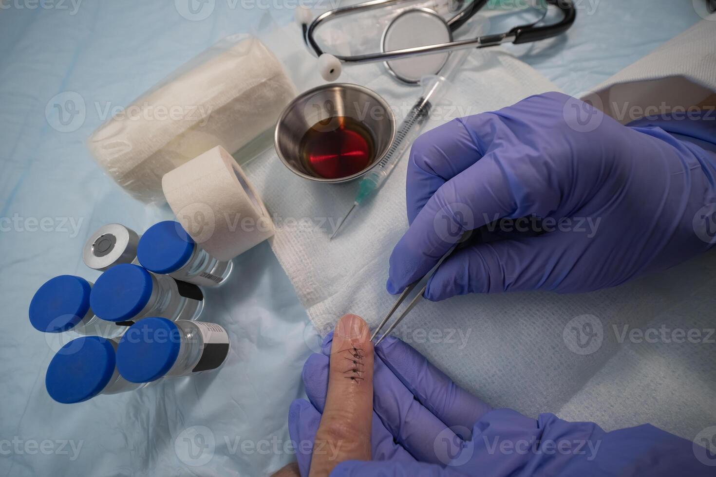 Stitched finger with medical instruments, about to remove sutures photo