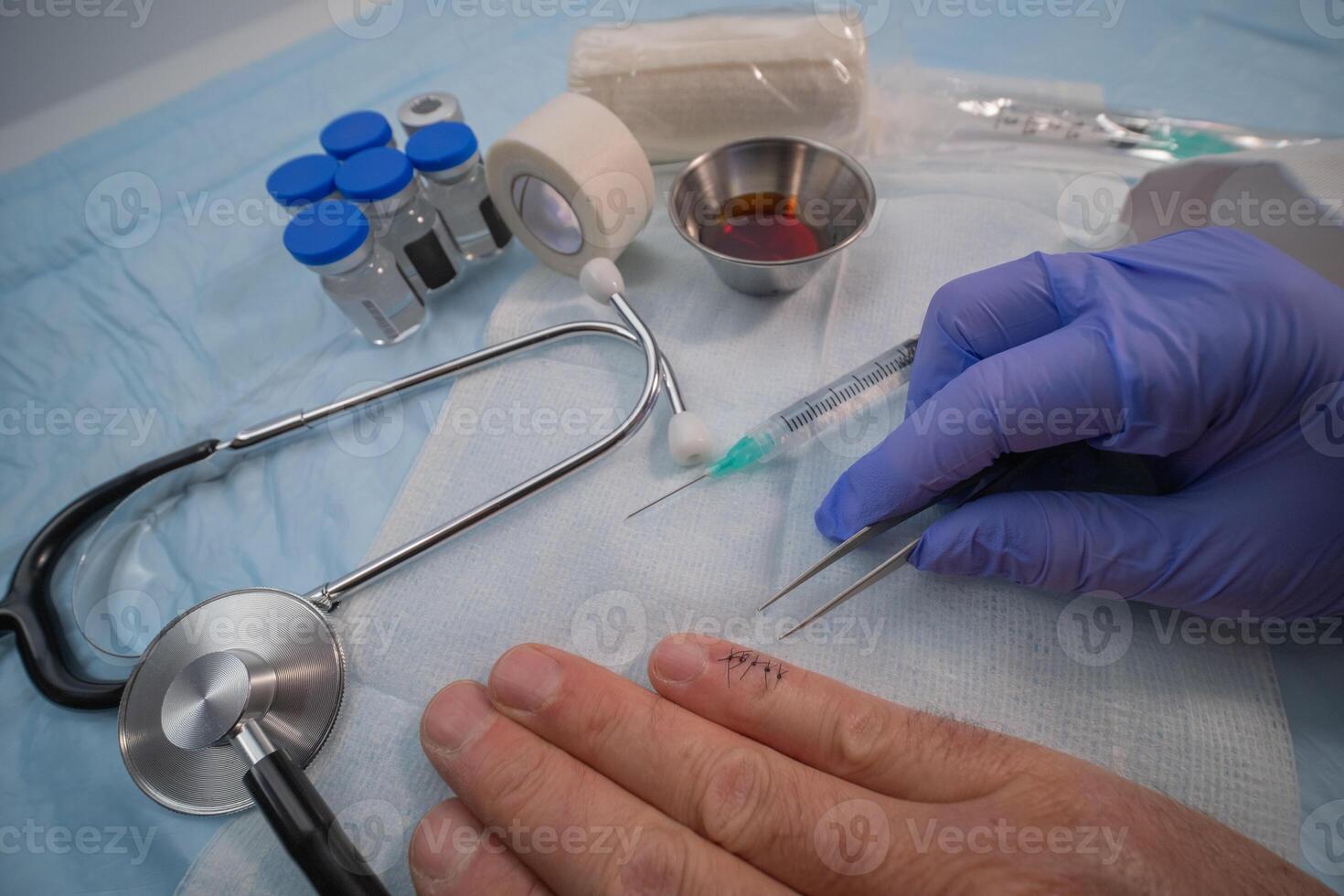 Stitched finger with medical instruments, about to remove sutures photo