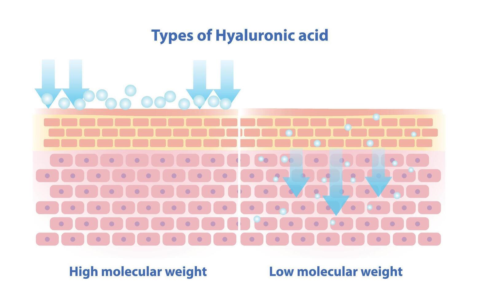 Types of Hyaluronic acid illustration. High molecular weight HA stay on skin surface to lock in moisture. Low molecular penetrate deeper in skin to boost collagen, plumping skin from within. vector