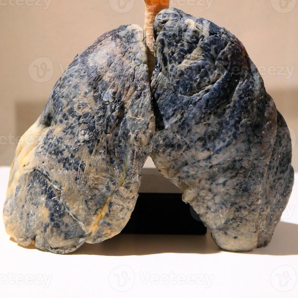 Evidence of damage on smoker lungs photo
