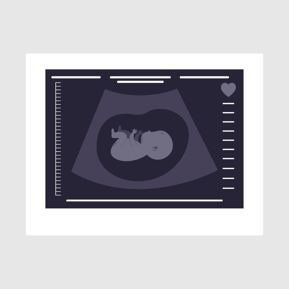 Ultrasound of a child. An ultrasound scan of the fetus of a pregnant woman. Medical diagnosis concep vector