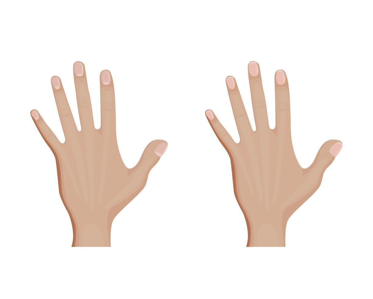 Before and after French manicure. Nail polish or gel. vector