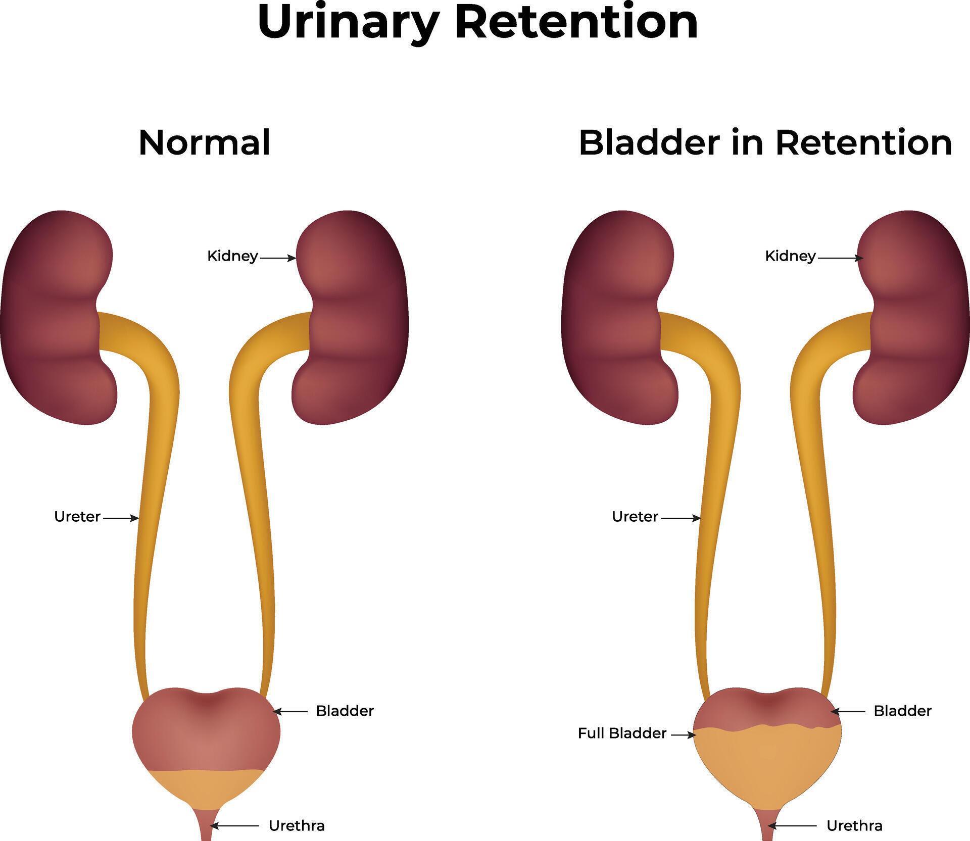gabapentin for urinary retention