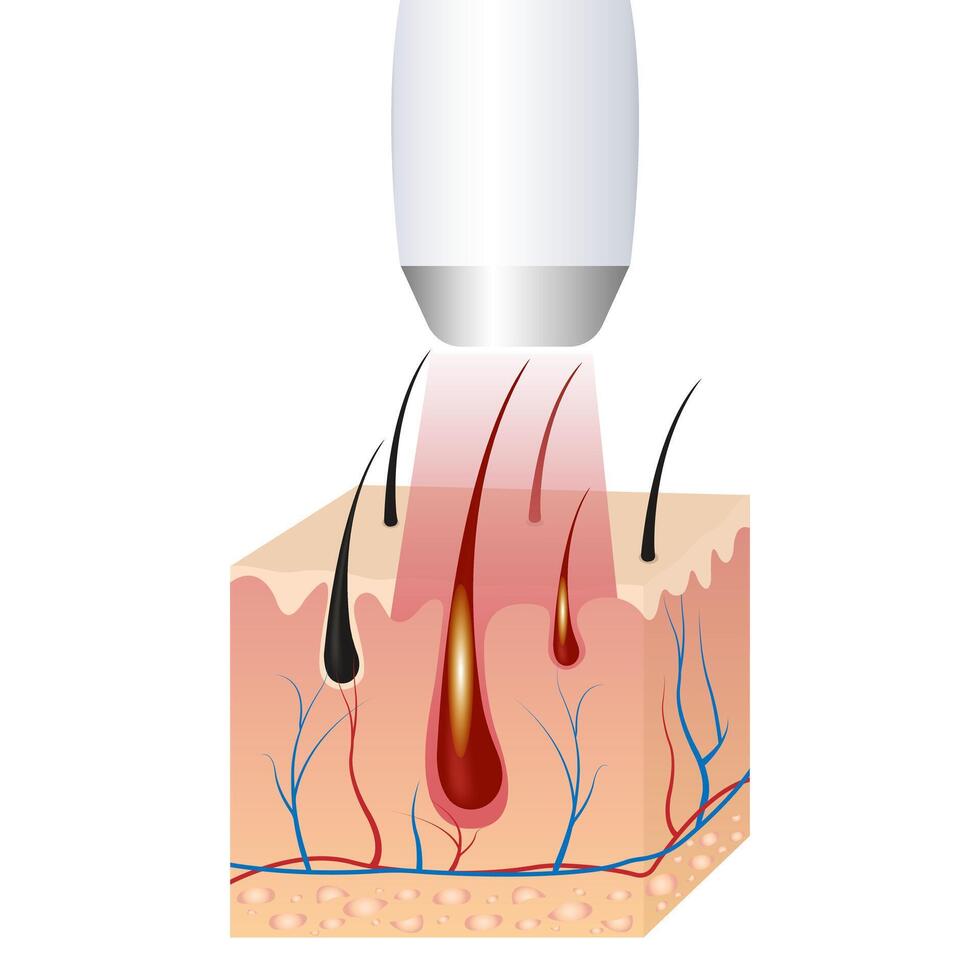 IPL HAIR REMOVAL vector