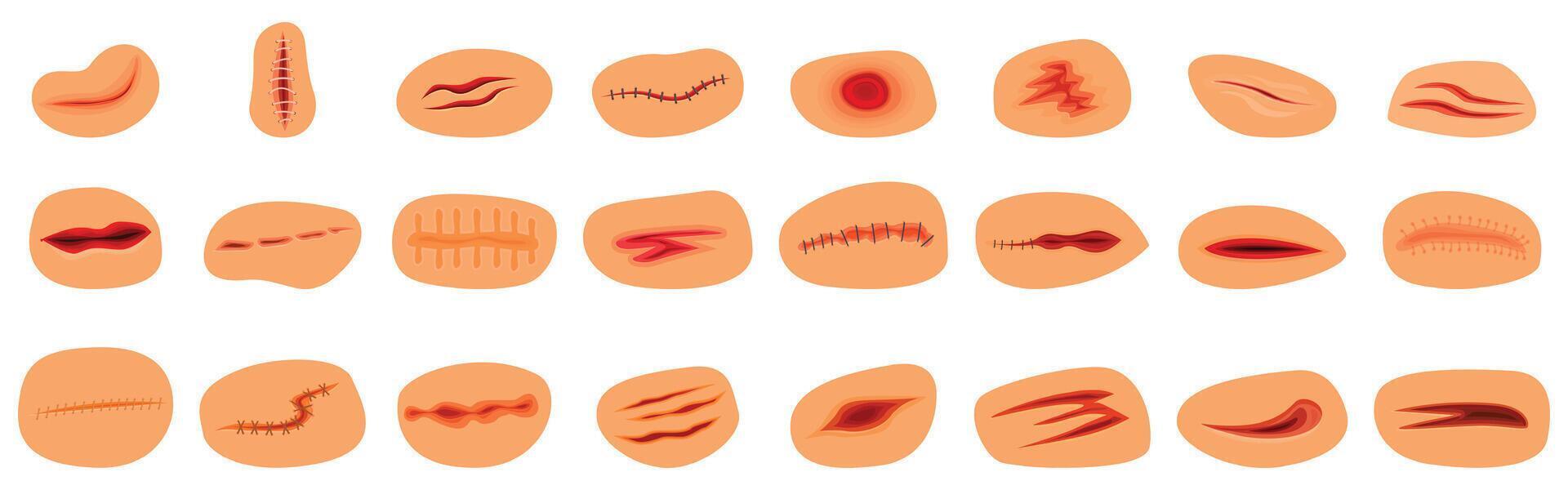 Bloody wounds icons set. Different types of injuries showing skin damage and stitches vector