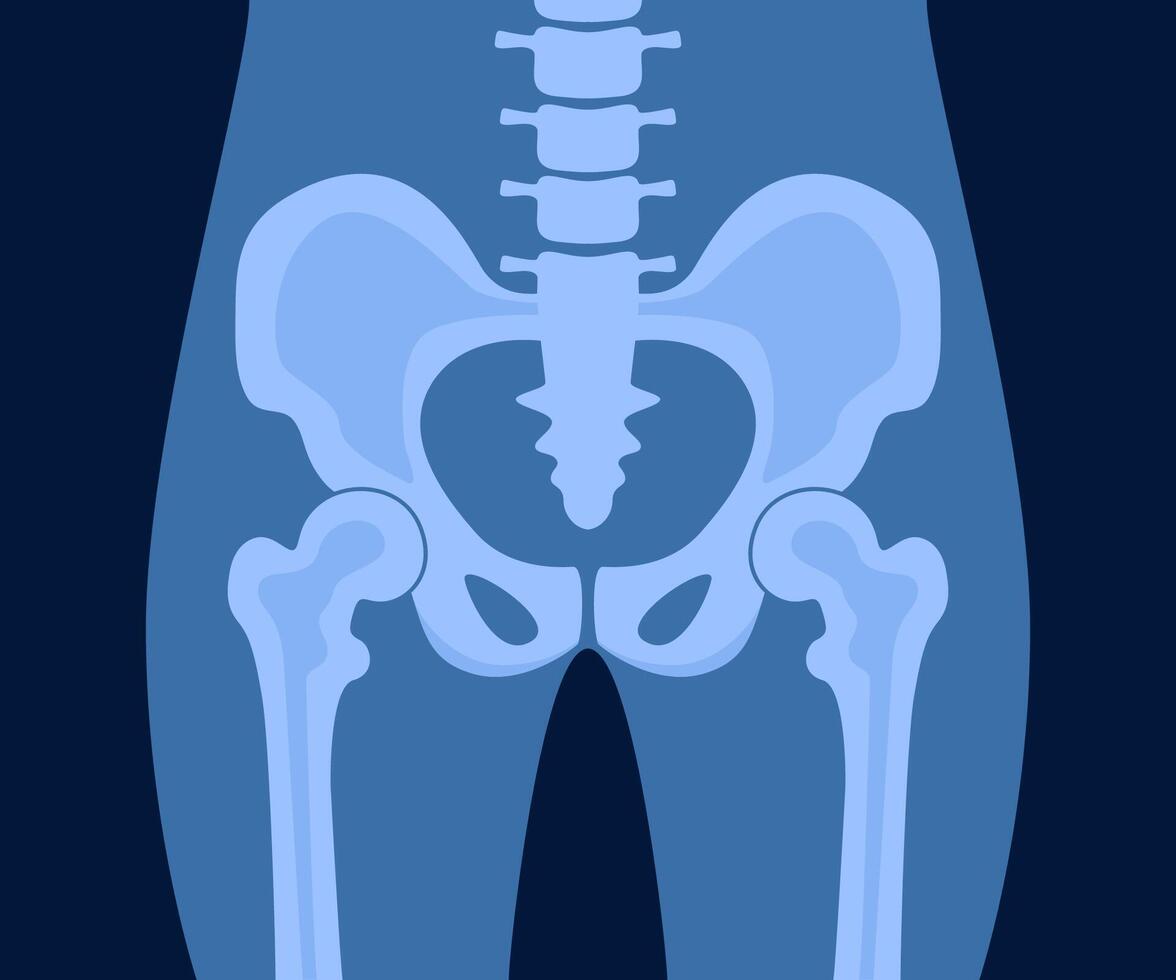 XRay of hip joint pelvis human bones anatomy orthopedic medical diagnostic. X ray roentgen radiology shot surgery femur healthy skeleton spine anatomical structure image. illustration. vector