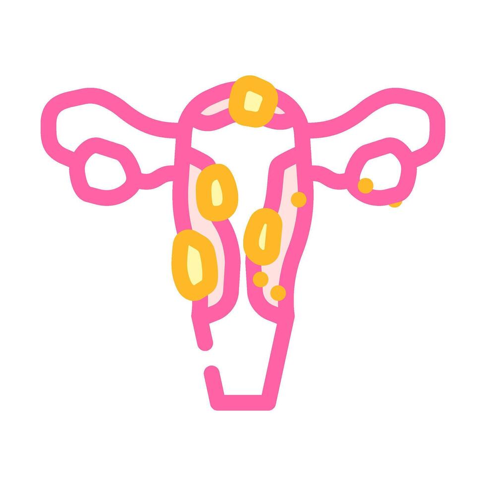 uterine fibroids woman disease color icon illustration vector