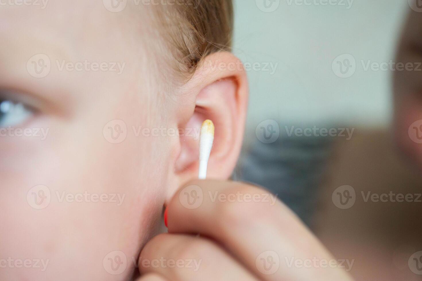 Cleaning the ears of a 5-year-old child from sulfur with cotton swabs, close-up. Hygiene procedure. photo