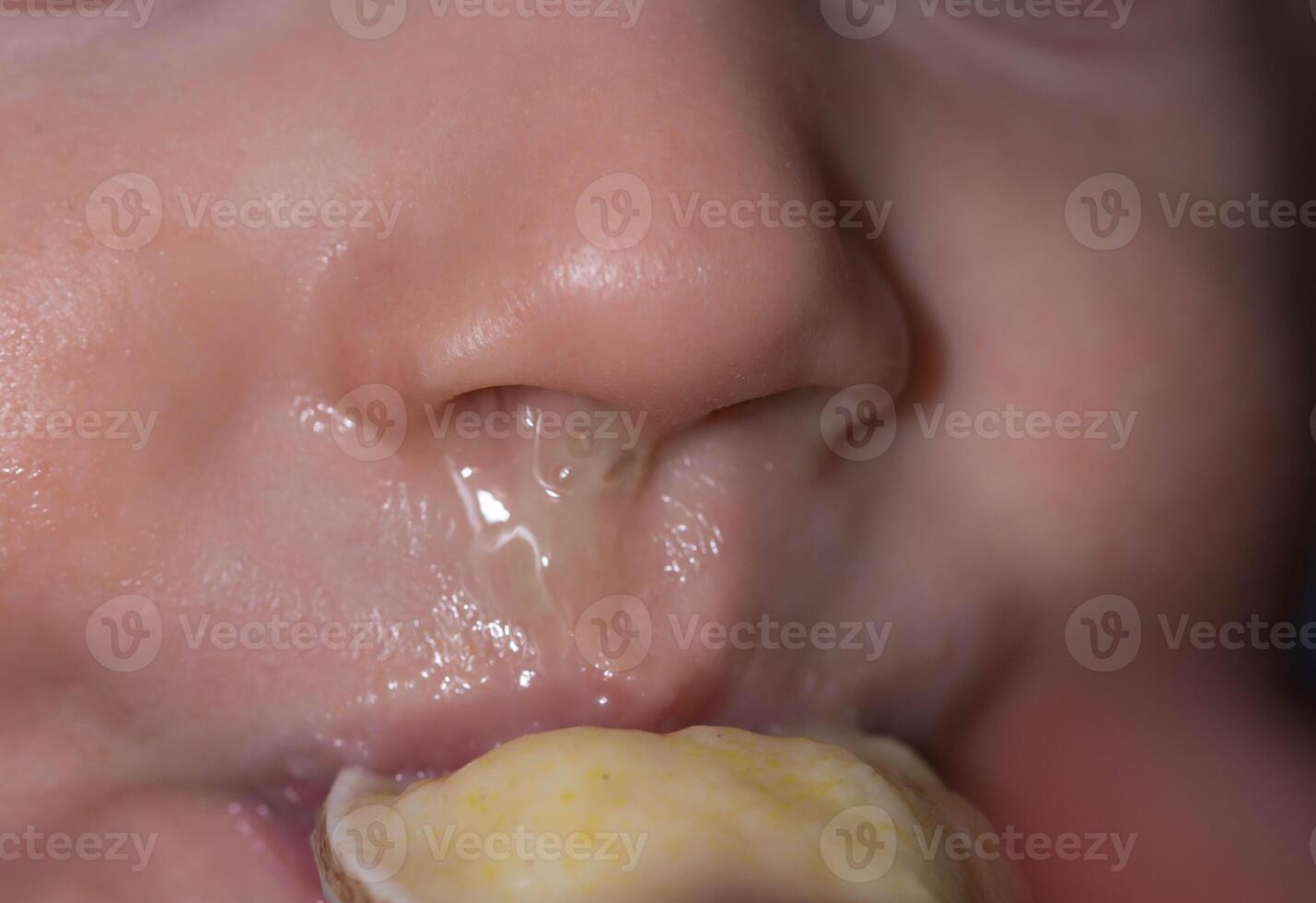 Bacterial diseases in the nose. Yellow snot from the nose of a little boy. Colds and infectious diseases, allergies. Close-up photo