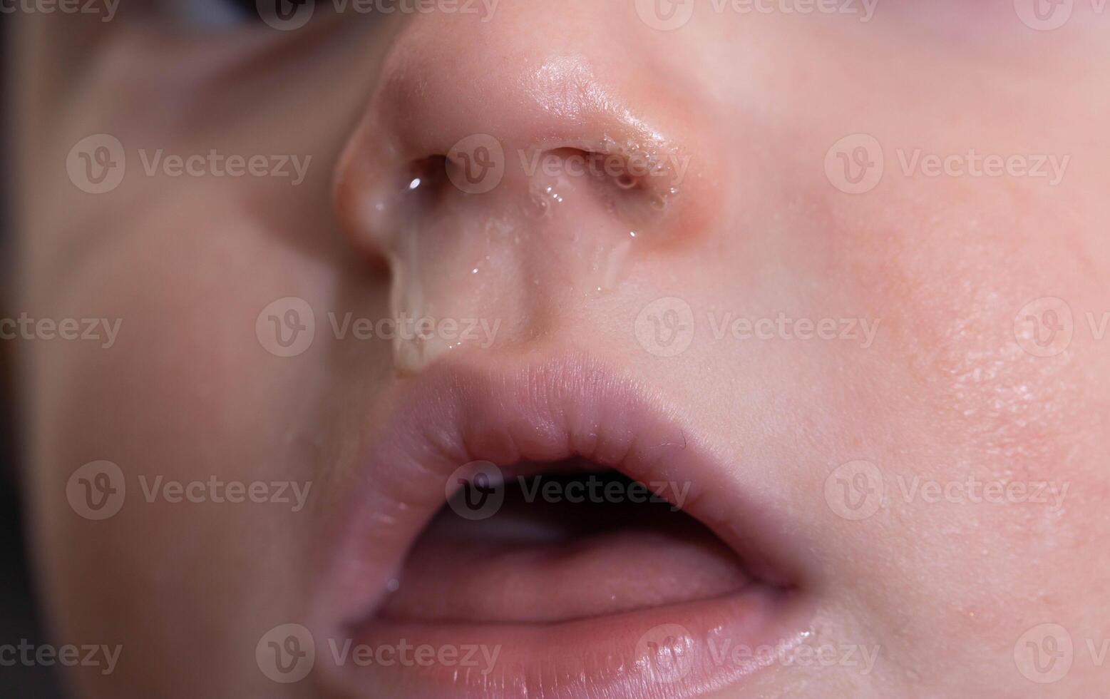 Close-up of a small child's face and nose with snot. The concept of colds, rhinitis and runny nose in children. photo