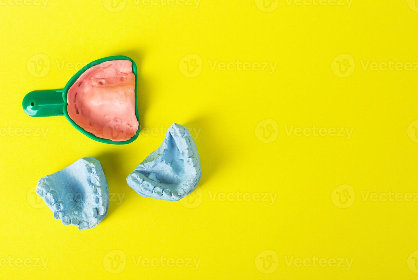 Blue plaster cast of a dental jaw and a dental tray for an impression of a dental jaw on a yellow background. The concept of orthodontics in dentistry, the manufacture of dentures and crowns. photo