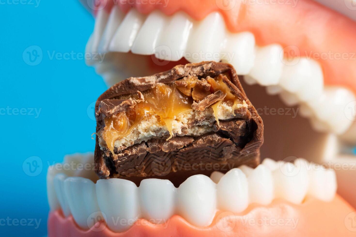 A bitten piece of chocolate in a dental jaw mockup on a blue background. The concept of the effect of sugar and leftover food on teeth and tooth enamel. Tooth destruction by bacteria, caries photo