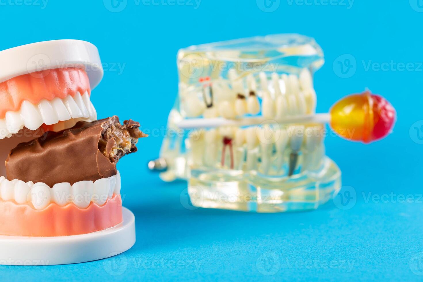 Two mock-ups of dental jaws with a lollipop and a chocolate bar on a blue background. The concept of the destructive effect on tooth enamel and teeth after eating sweets. photo
