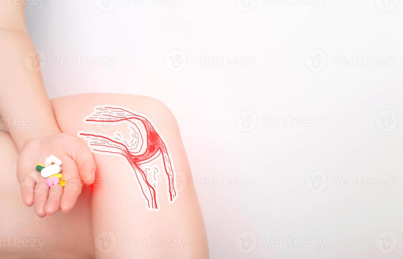 The girl holds a handful of pills in her hand for pain in the knee joint. Concept of drugs for the treatment and restoration of cartilage tissue in the knee joint, copy space for text photo