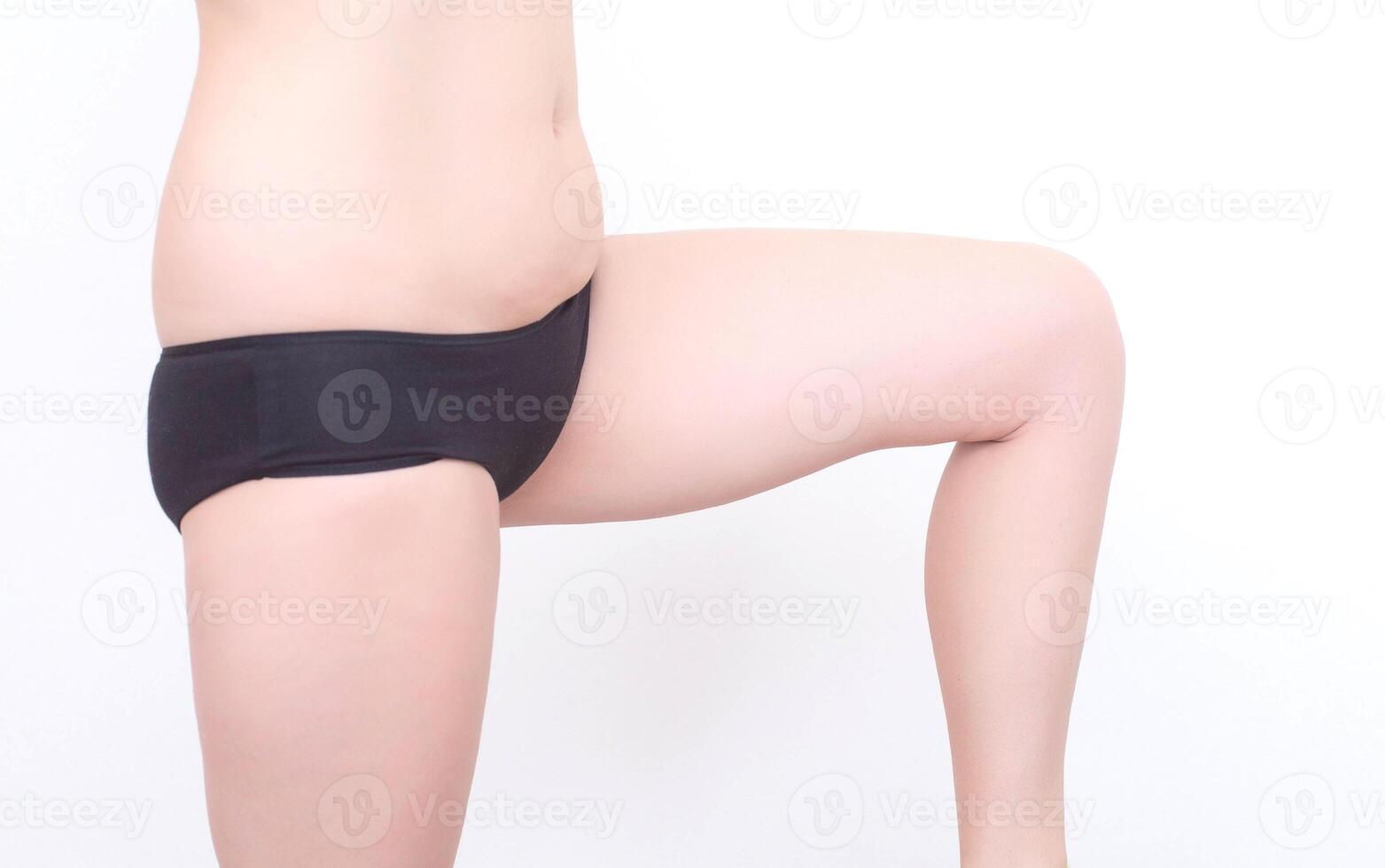 Distressed female legs with saggy skin on the thighs and cellulite on a white background, isolate. The concept of skin tone and proper nutrition, body care, plastic surgery photo