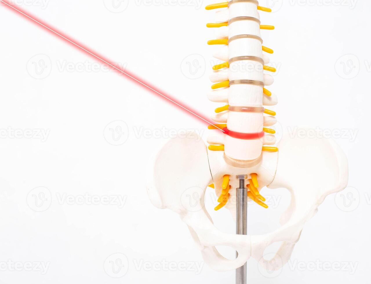Mock up human spine on a white background with a laser. The concept of a new modern method without surgery for the treatment and removal of intervertebral hernias, copy space photo