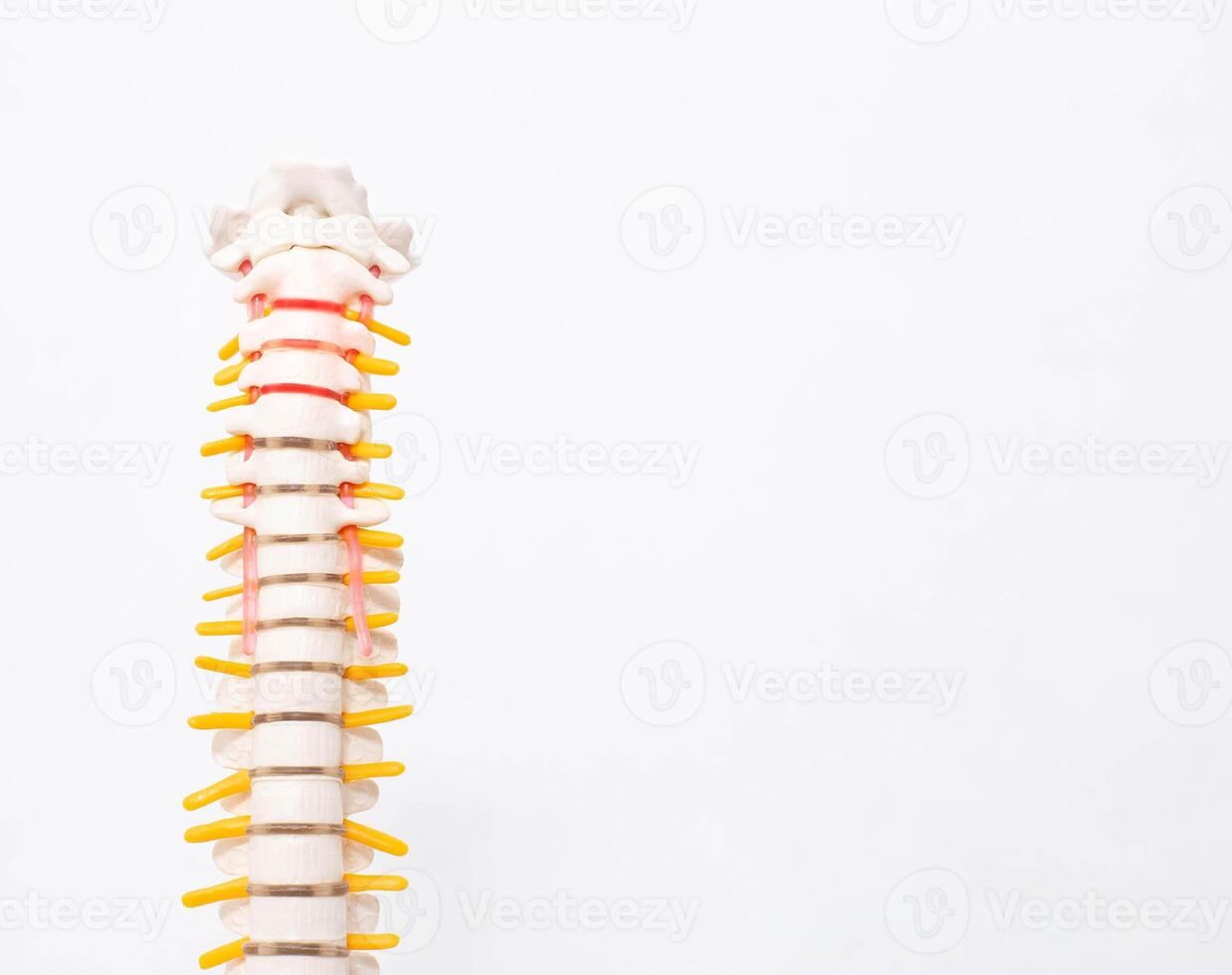 Cervical and thoracic spine on a white background. Intervertebral hernia of the cervical spine, rupture of the fibrous ring. Osteochondrosis, copy space photo