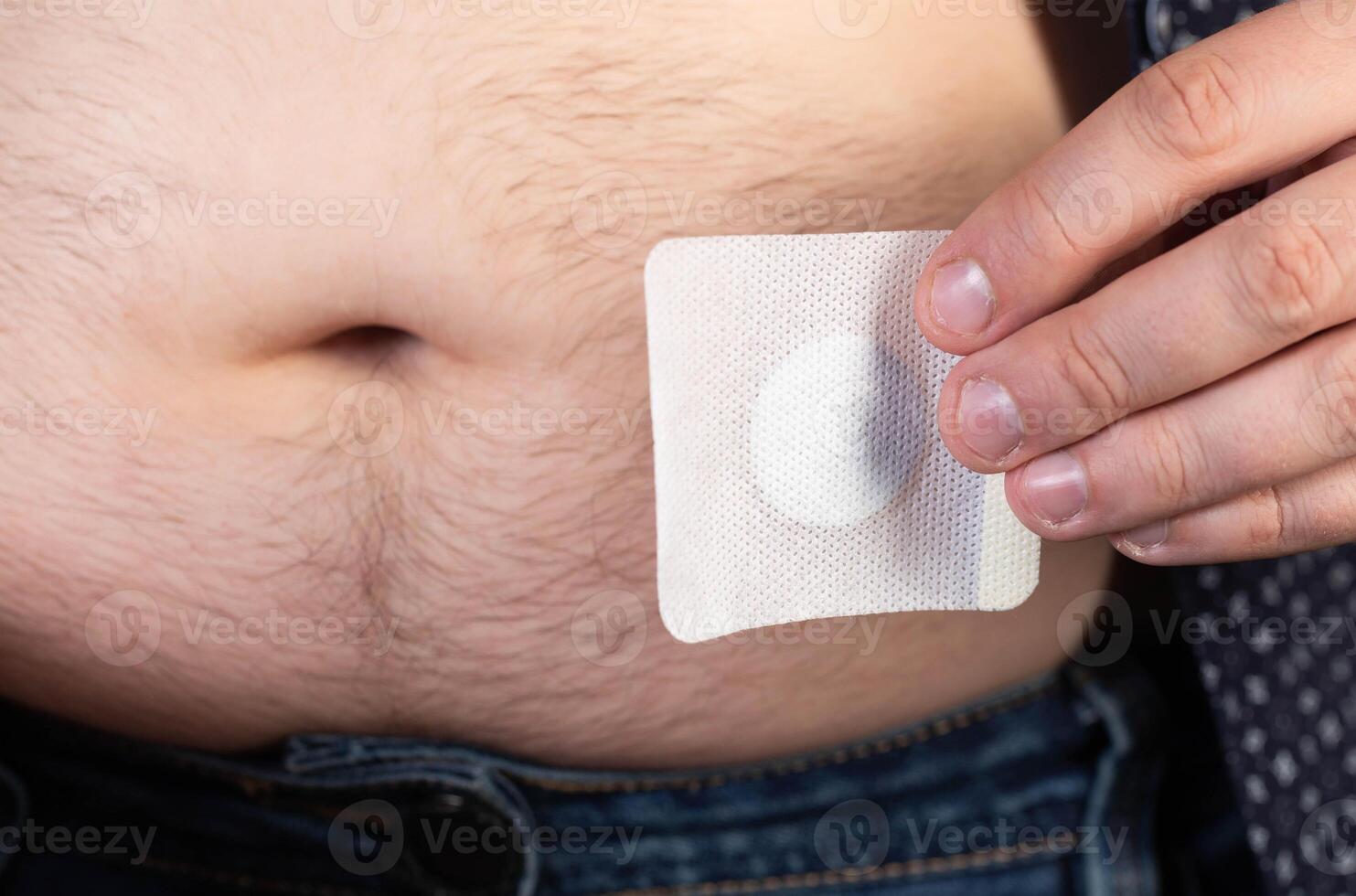 A modern medical patch for prostatitis and urinary tract infections. A man glues a urological patch on his stomach, close-up photo