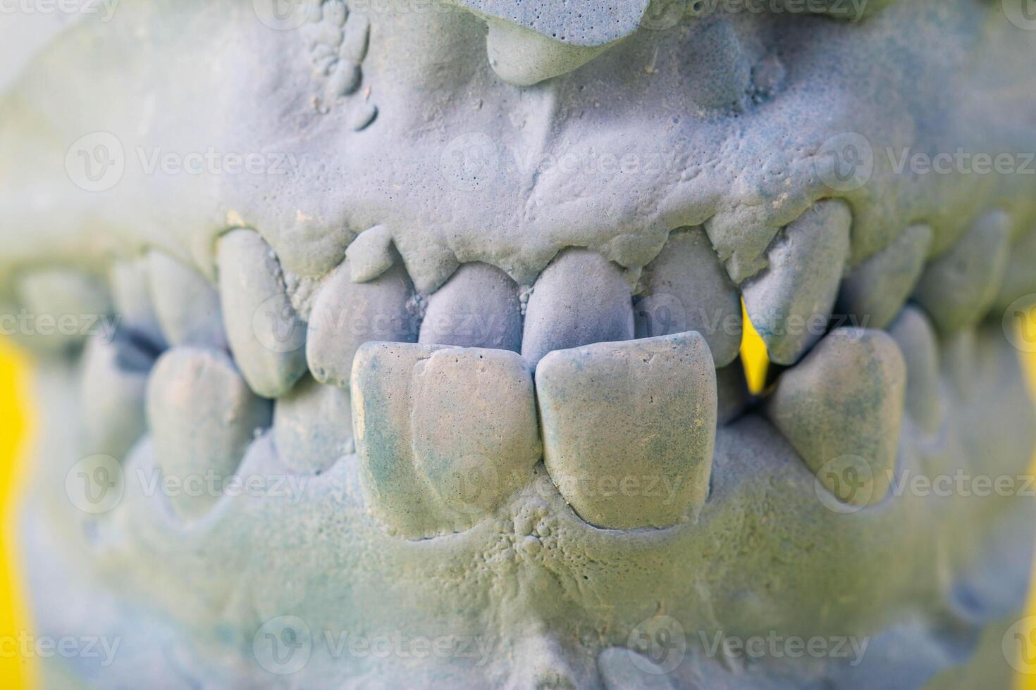 Blue plaster impression of the dental jaw of a patient with crooked teeth and malocclusions. Manufacturing of dentures and crowns based on orthodontic impressions, close-up photo