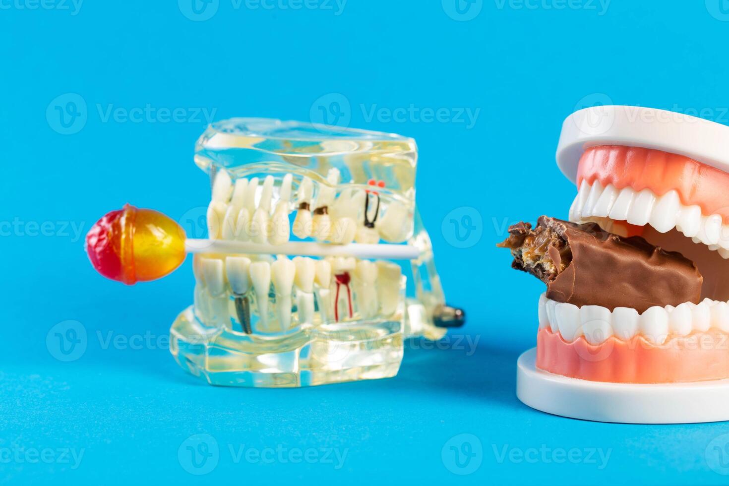 Two mock-ups of dental jaws with a lollipop and a chocolate bar on a blue background. The concept of the destructive effect on tooth enamel and teeth after eating sweets. Caries and pulpitis photo