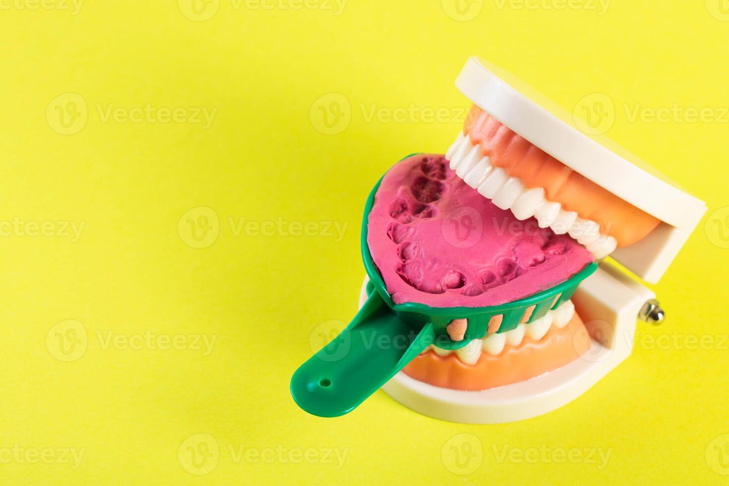 Green dental spoon for taking a dental impression in a mock-up of a dental jaw on a yellow background. Making an artificial jaw for malocclusion. Manufacturing of dental prostheses photo