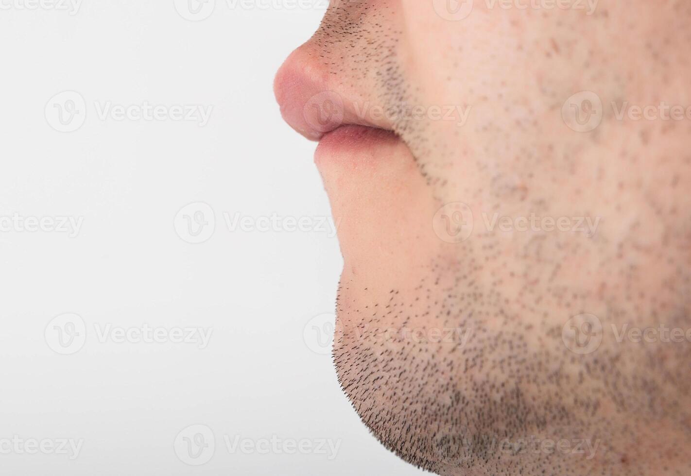 A man has a large upper lip, close-up. Reduction and correction of lips using plastic surgery, cheiloplasty photo