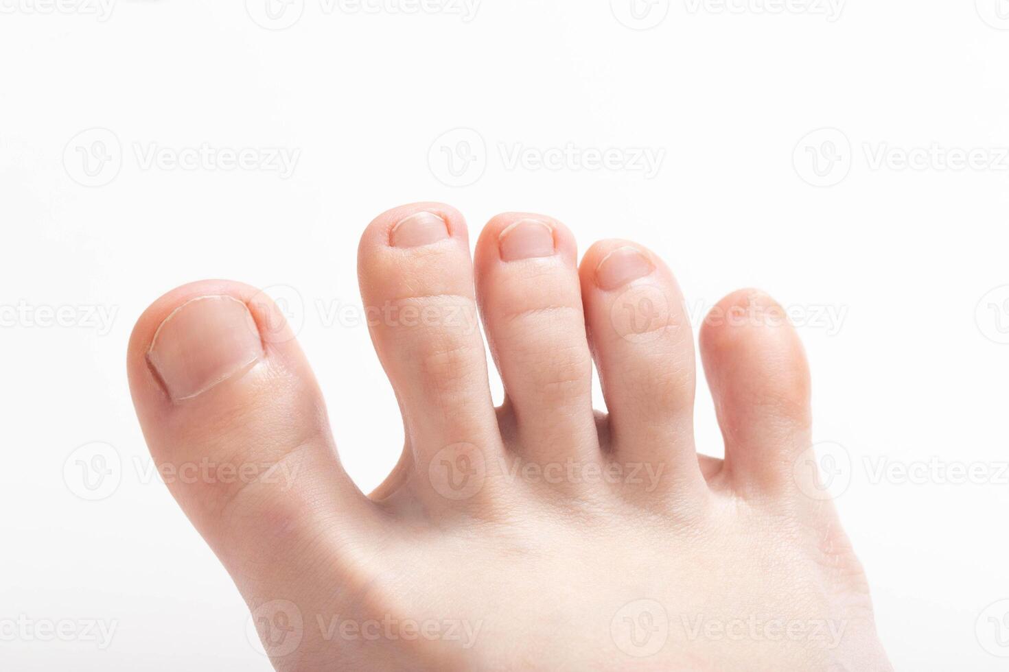 Toes on a white background. Concept of unpleasant foot odor, bacteria and fungus between the toes photo