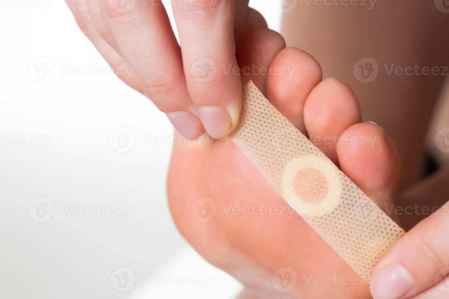 A girl sticks a medical plaster for plantar warts on her leg. Callus treatment. Copy space for text photo