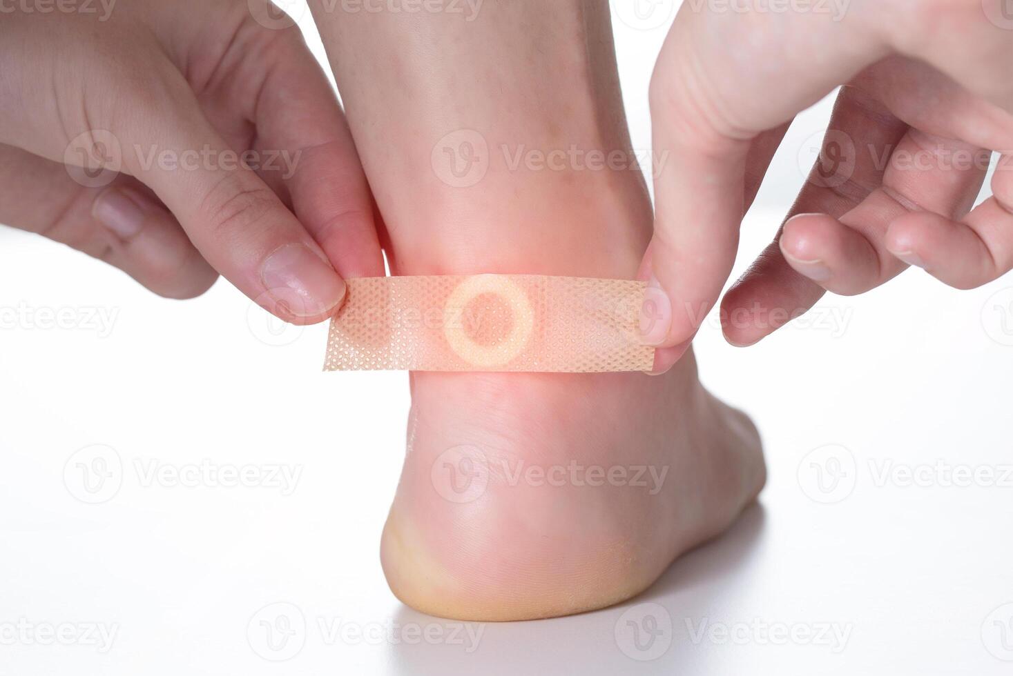 A woman sticks a medical plaster for the treatment of warts on the foot. Close-up photo