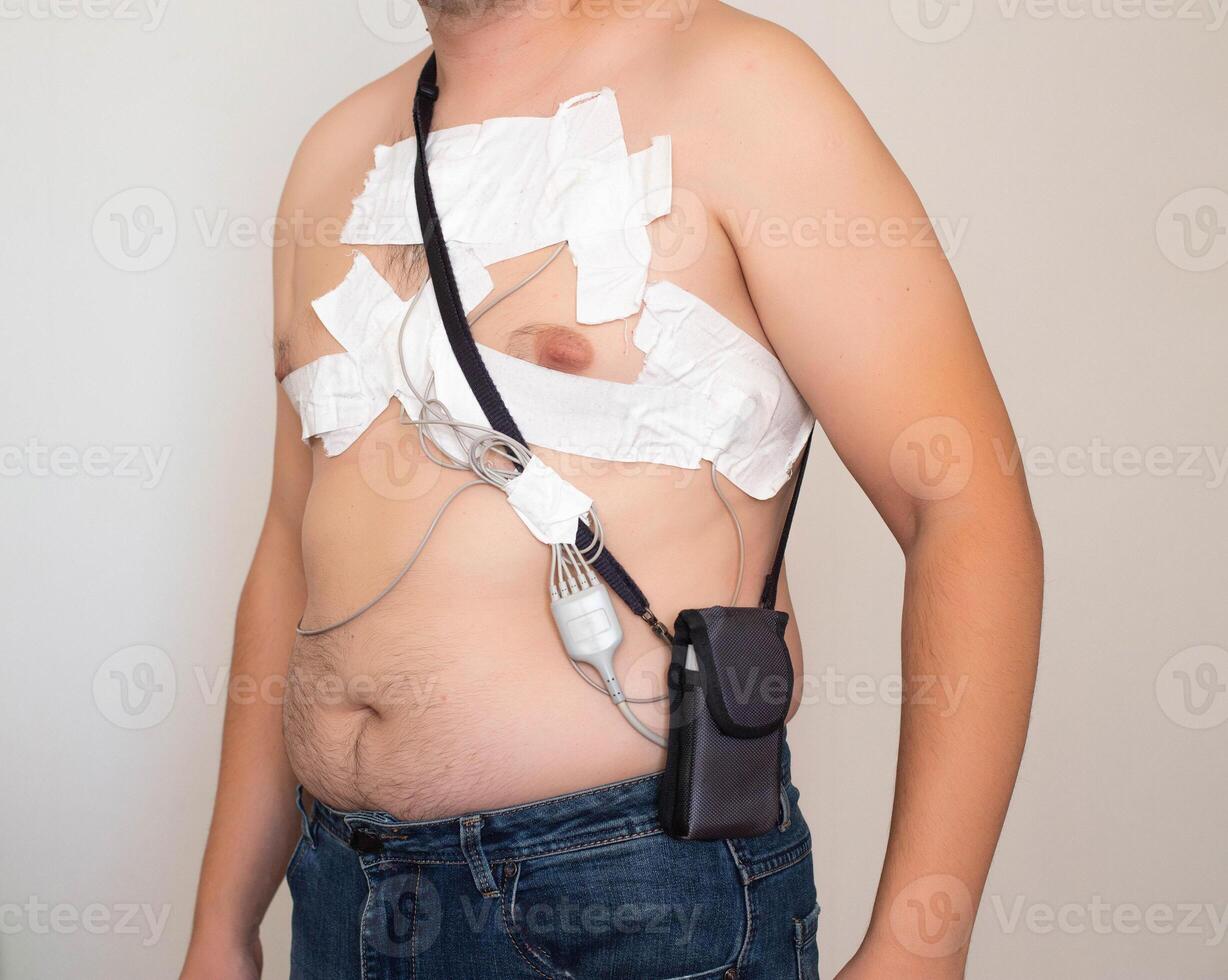 An obese man undergoes a Holter monitoring of the heart. A modern method for studying the heart in caodiology. Arrhythmia and ischemic disease. Medic photo